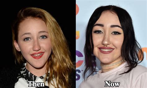 noah cyrus before after|We Cant Stop Staring At Noah Cyrus Transformation